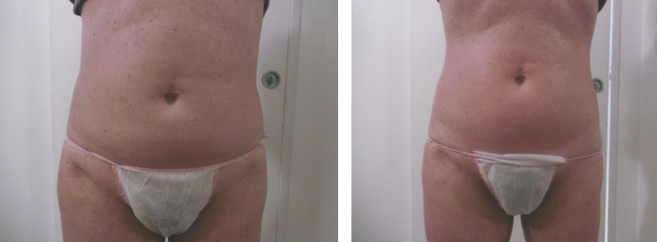 cosmesi clinica corpo