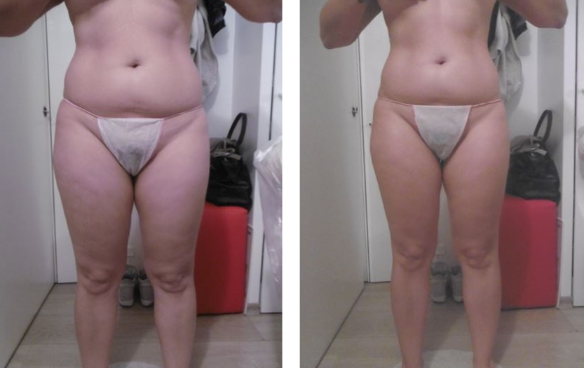 cosmesi clinica corpo