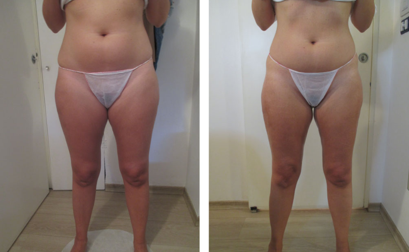 cosmesi clinica corpo