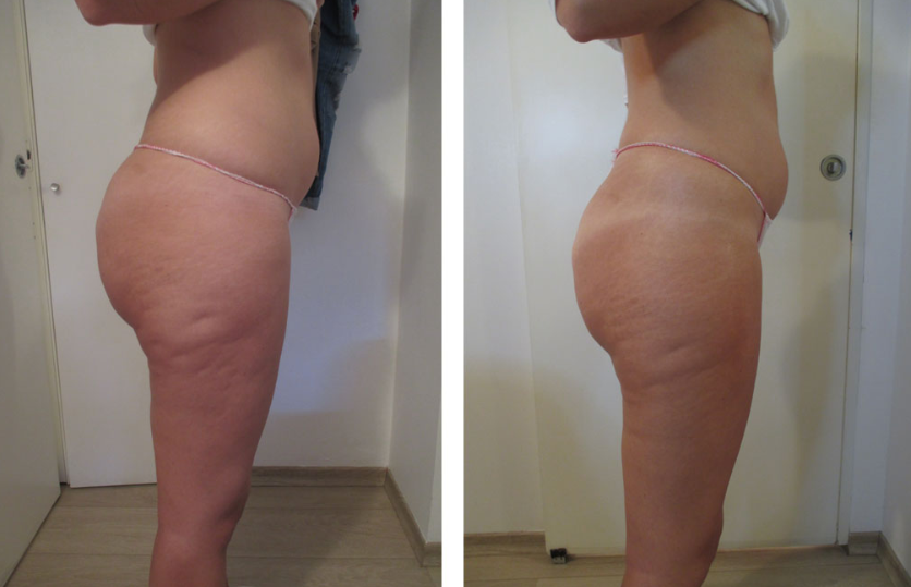 cosmesi clinica corpo