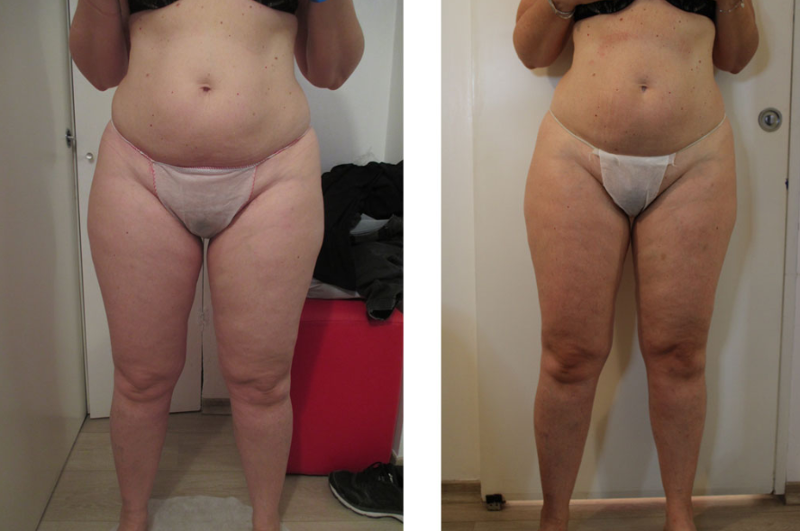 cosmesi clinica corpo