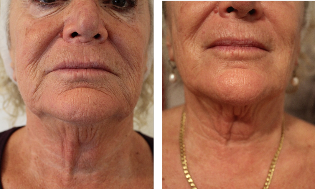 cosmesi clinica