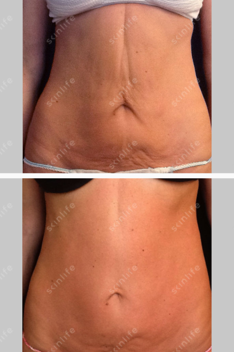 skin life corpo