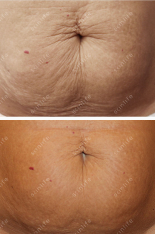skin life corpo
