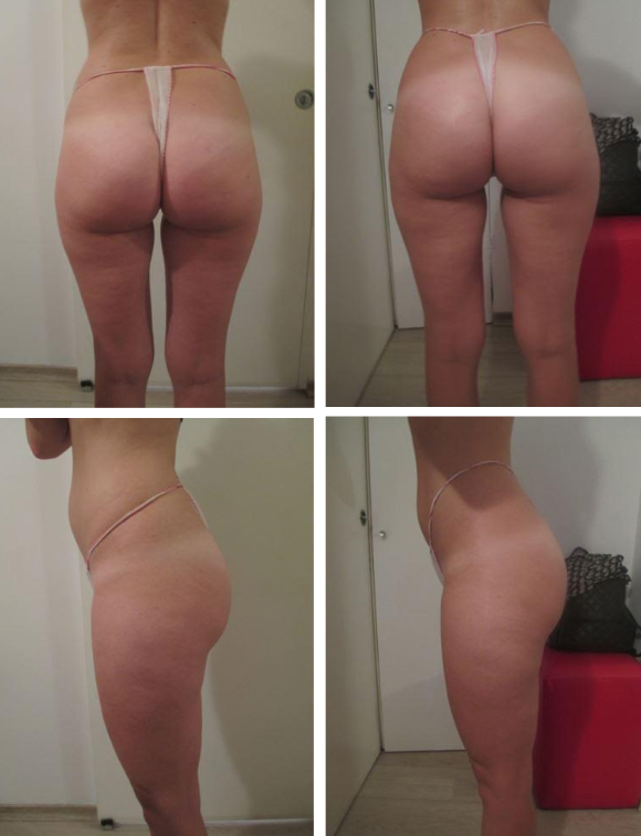 skin life corpo