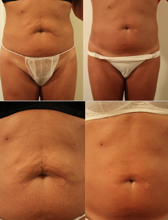 skin life corpo