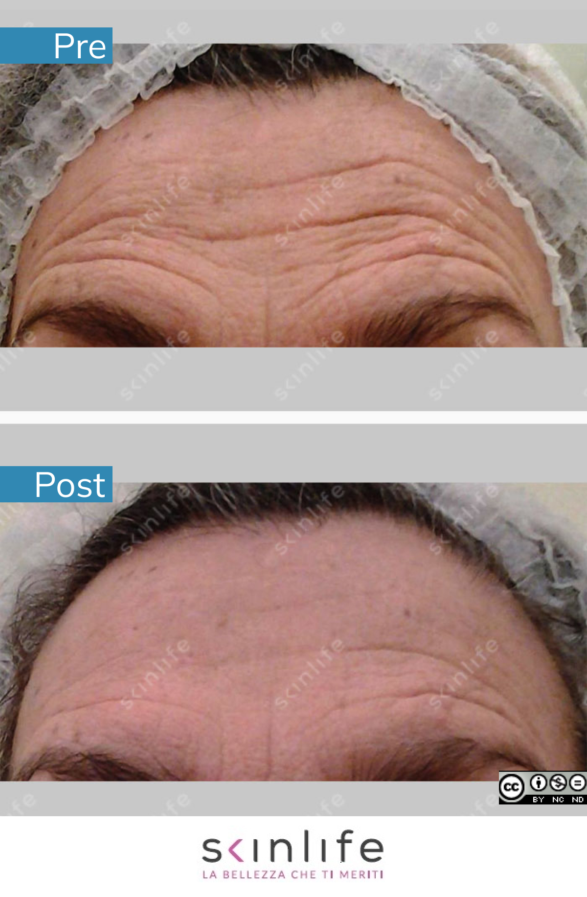 trattamento viso skinlife prima e dopo