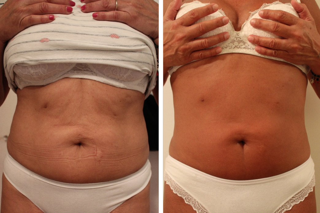 thermactive corpo