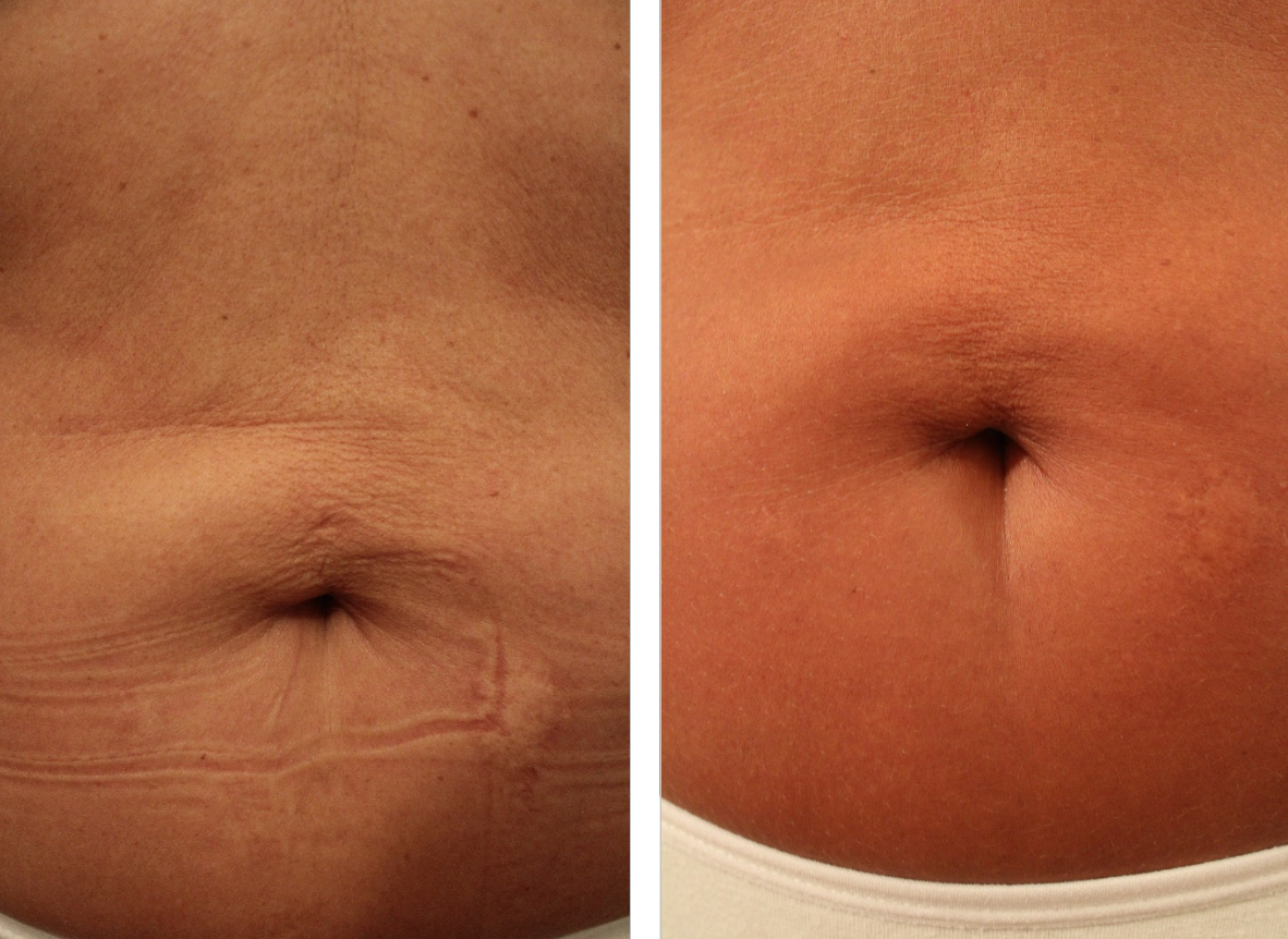thermactive corpo